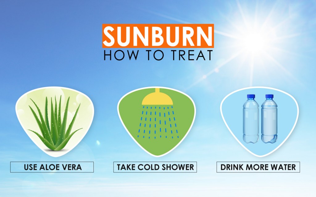Infographic on Treating a Sunburn